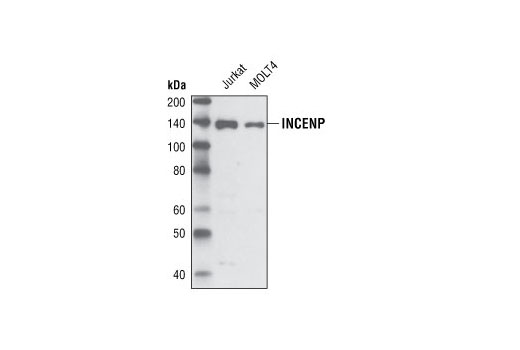Western Blotting Image 1: INCENP (P240) Antibody