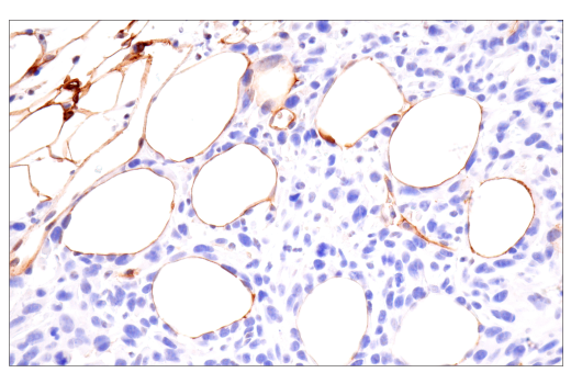 Immunohistochemistry Image 6: CD36 (E8B7S) Rabbit mAb