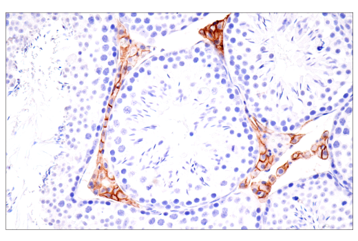 Immunohistochemistry Image 4: CD36 (E8B7S) Rabbit mAb