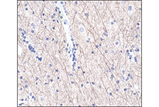 Immunohistochemistry Image 1: Neurofilament-L (DA2) Mouse mAb