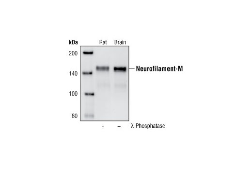 Western Blotting Image 1: Neurofilament-M (RMO 14.9) Mouse mAb