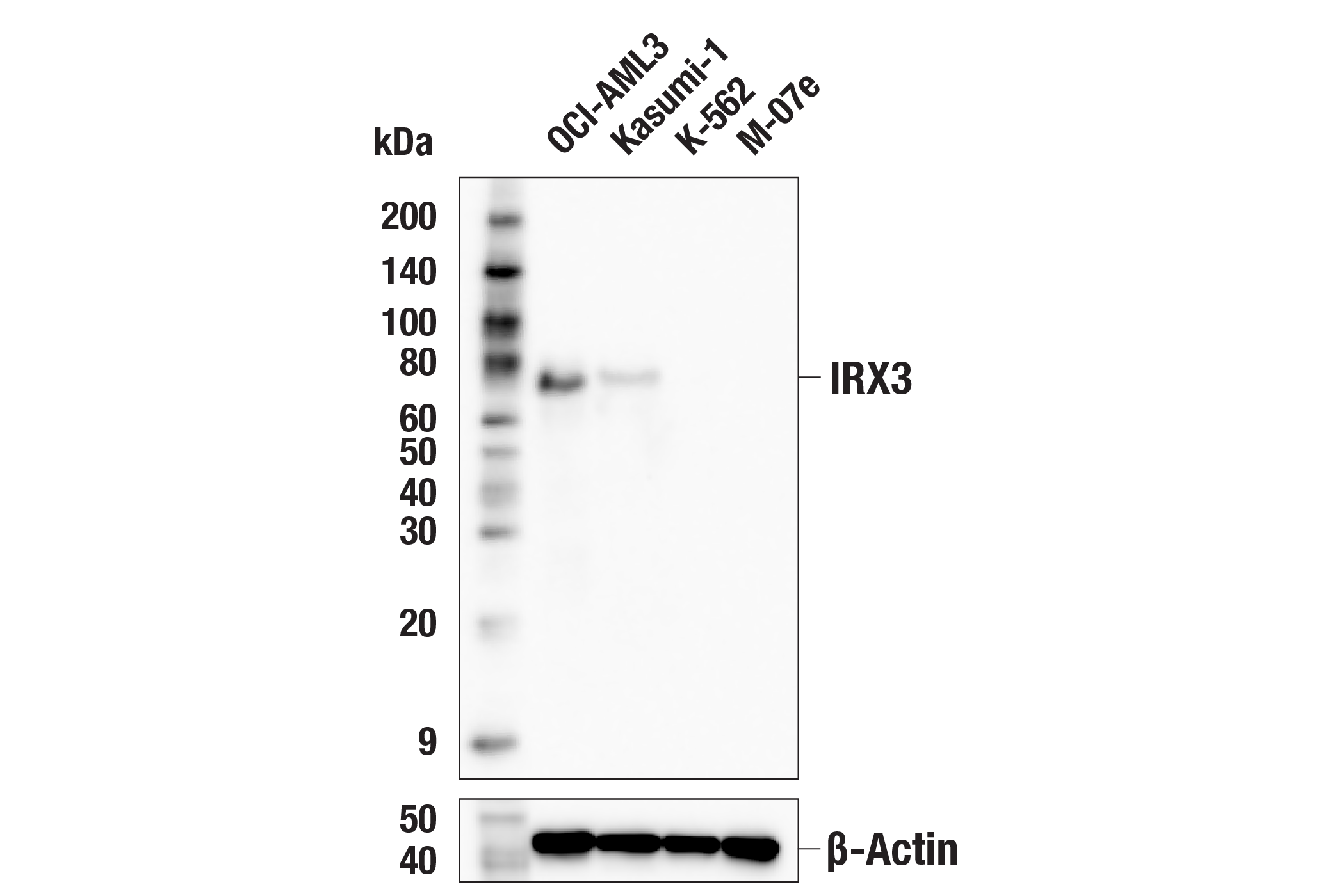 Western Blotting Image 1: IRX3 (F7S2F) Rabbit mAb