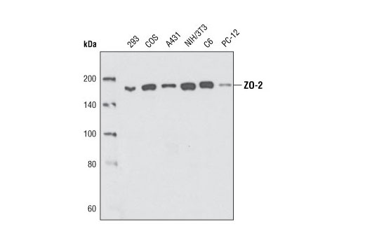  Image 4: Tight Junction Antibody Sampler Kit