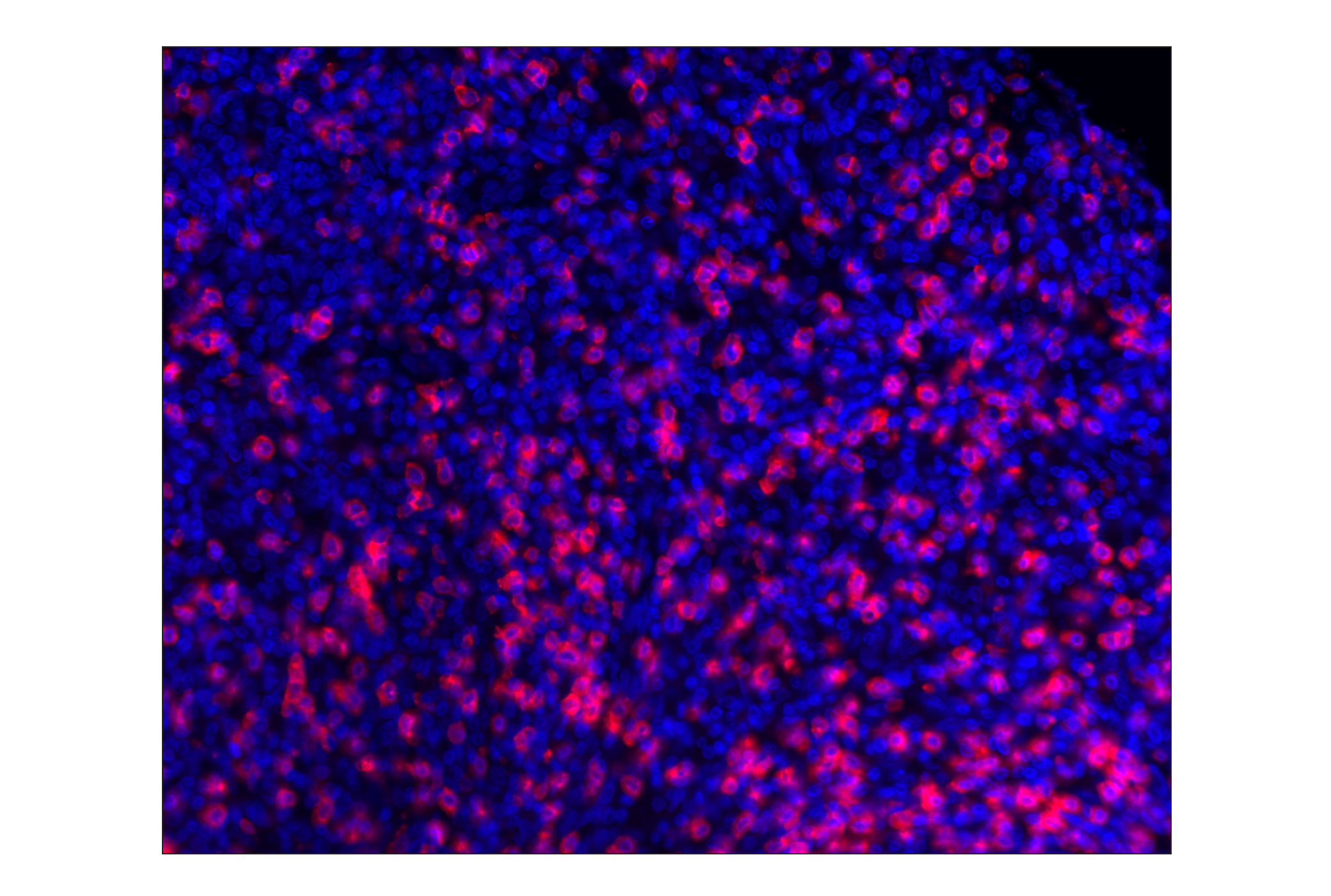 Immunohistochemistry Image 1: CD8α (D8A8Y) Rabbit mAb (Alexa Fluor® 647 Conjugate)