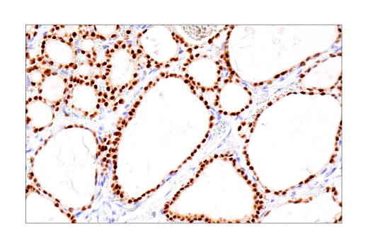 Immunohistochemistry Image 3: PAX8 (BC12) Mouse mAb
