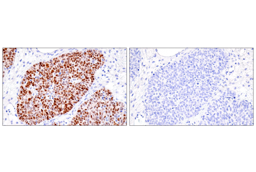 Immunohistochemistry Image 4: PAX8 (BC12) Mouse mAb