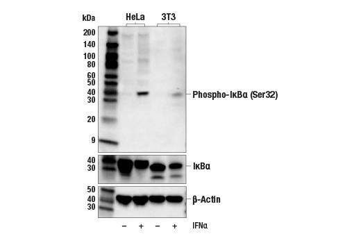 Phospho-IκBα (Ser32) (14D4) Rabbit mAb | Cell Signaling Technology