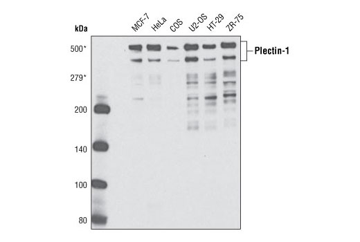 Western Blotting Image 1: Plectin-1 Antibody