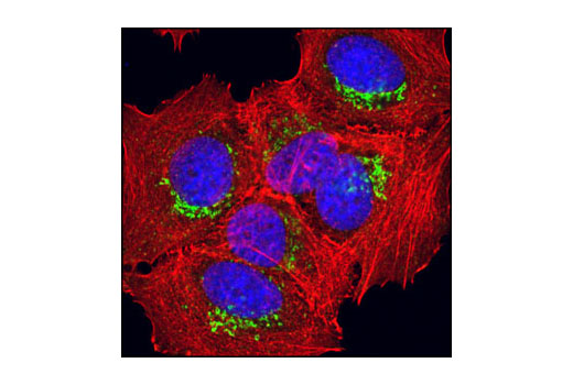Immunofluorescence Image 1: Syntaxin 6 (C34B2) Rabbit mAb