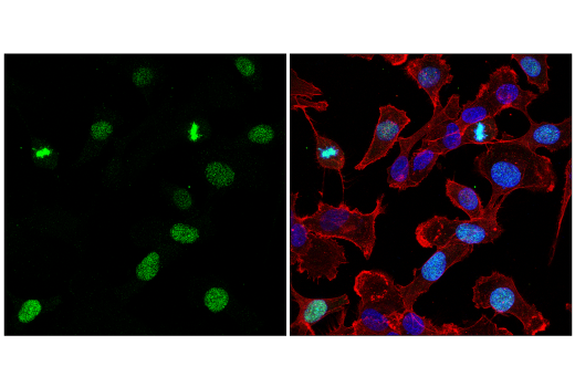 Immunofluorescence Image 1: Aurora B/AIM1 (E3R8N) Rabbit mAb