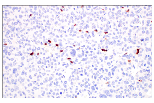 Immunohistochemistry Image 3: CD177 (E1V7N) Rabbit mAb