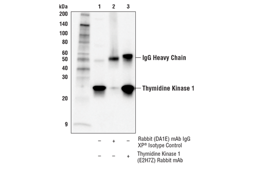 Immunoprecipitation Image 1: Thymidine Kinase 1 (E2H7Z) Rabbit mAb