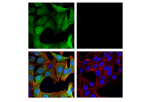 Immunofluorescence Image 1: Thymidine Kinase 1 (E2H7Z) Rabbit mAb