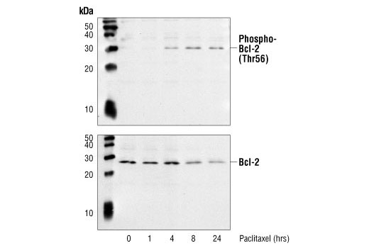 Western Blotting Image 1: Phospho-Bcl-2 (Thr56) Antibody (Human Specific)