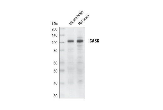Western Blotting Image 1: CASK Antibody
