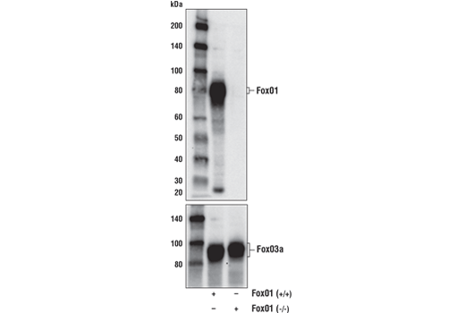  Image 5: Forkhead Signaling Antibody Sampler Kit