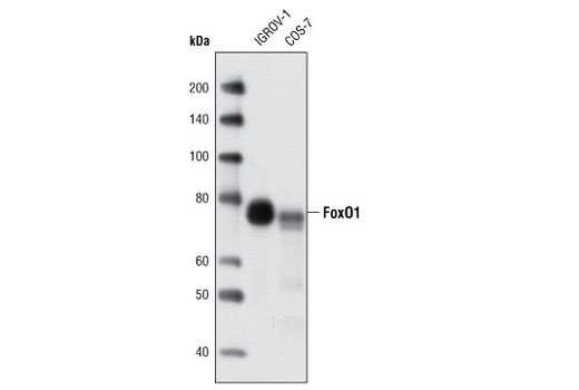  Image 13: Forkhead Signaling Antibody Sampler Kit