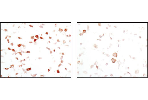 Immunohistochemistry Image 4: FoxO1 (C29H4) Rabbit mAb (BSA and Azide Free)