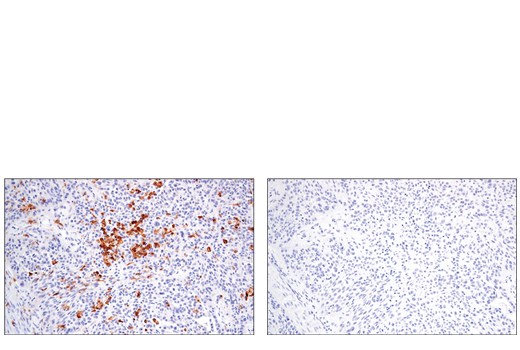  Image 28: Suppressive Myeloid Cell Phenotyping IHC Antibody Sampler Kit