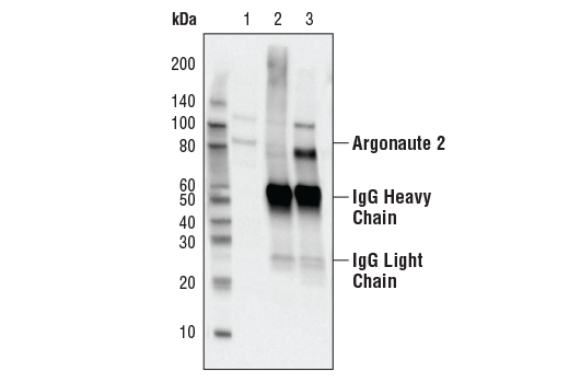 Immunoprecipitation Image 1: Argonaute 2 (C34C6) Rabbit mAb
