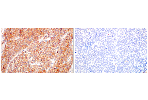 Immunohistochemistry Image 3: B-Raf (V600E Mutant) (IHC600) Mouse mAb