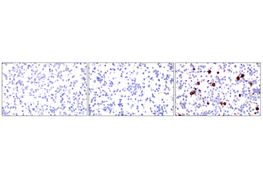 Immunohistochemistry Image 4: B-Raf (V600E Mutant) (IHC600) Mouse mAb