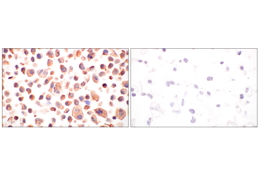 Immunohistochemistry Image 5: B-Raf (V600E Mutant) (IHC600) Mouse mAb