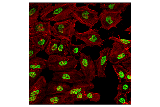 Immunofluorescence Image 1: Di-Methyl-Histone H3 (Lys36) (C75H12) Rabbit mAb
