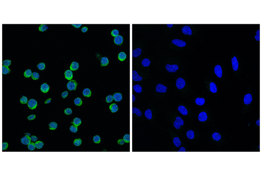 Immunofluorescence Image 1: BLNK (D3P2H) XP® Rabbit mAb (BSA and Azide Free)
