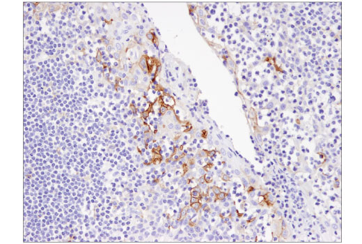 Immunohistochemistry Image 5: PD-L1 (405.9A11) Mouse mAb