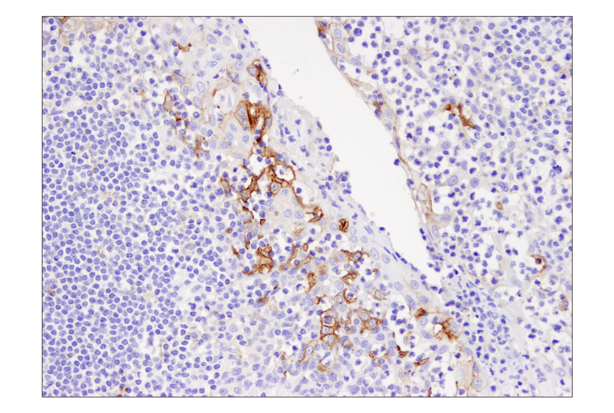 Immunohistochemistry Image 5: PD-L1 (405.9A11) Mouse mAb
