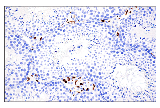 Immunohistochemistry Image 2: CD68 (E3O7V) Rabbit mAb (BSA and Azide Free)