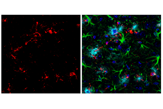 Immunofluorescence Image 2: CD68 (E3O7V) Rabbit mAb (BSA and Azide Free)