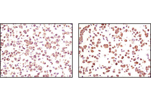 Immunohistochemistry Image 1: Akt (pan) (40D4) Mouse mAb (BSA and Azide Free)
