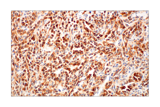  Image 32: Pro-Apoptosis Bcl-2 Family Antibody Sampler Kit II