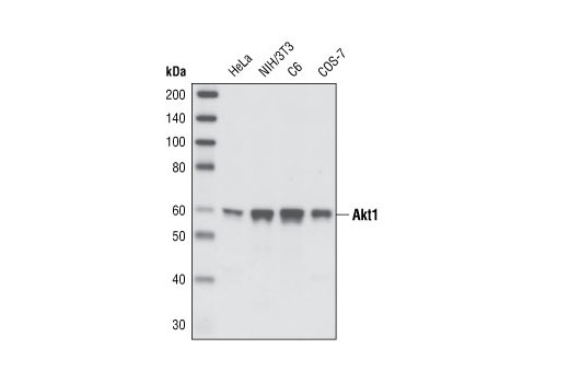  Image 1: Akt Isoform Antibody Sampler Kit
