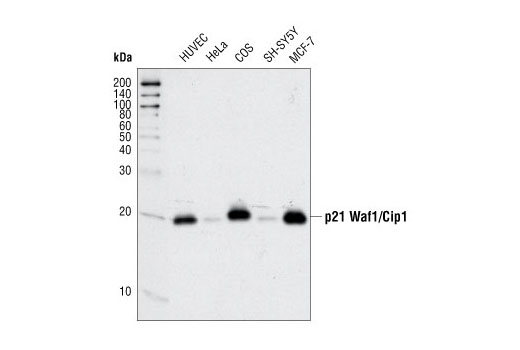  Image 16: Notch Activated Targets Antibody Sampler Kit