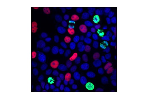  Image 33: Cell Cycle Regulation Antibody Sampler Kit