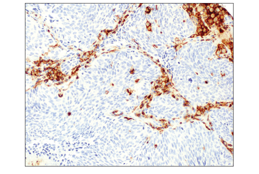 Immunohistochemistry Image 1: CD48 (D7L8I) XP® Rabbit mAb