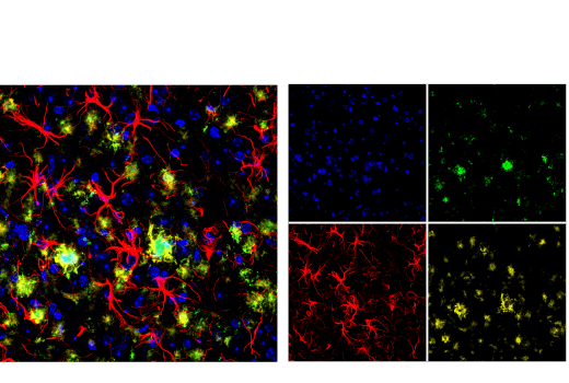 Immunofluorescence Image 1: β-Amyloid (1-43) (E8C2D) Rabbit mAb (BSA and Azide Free)