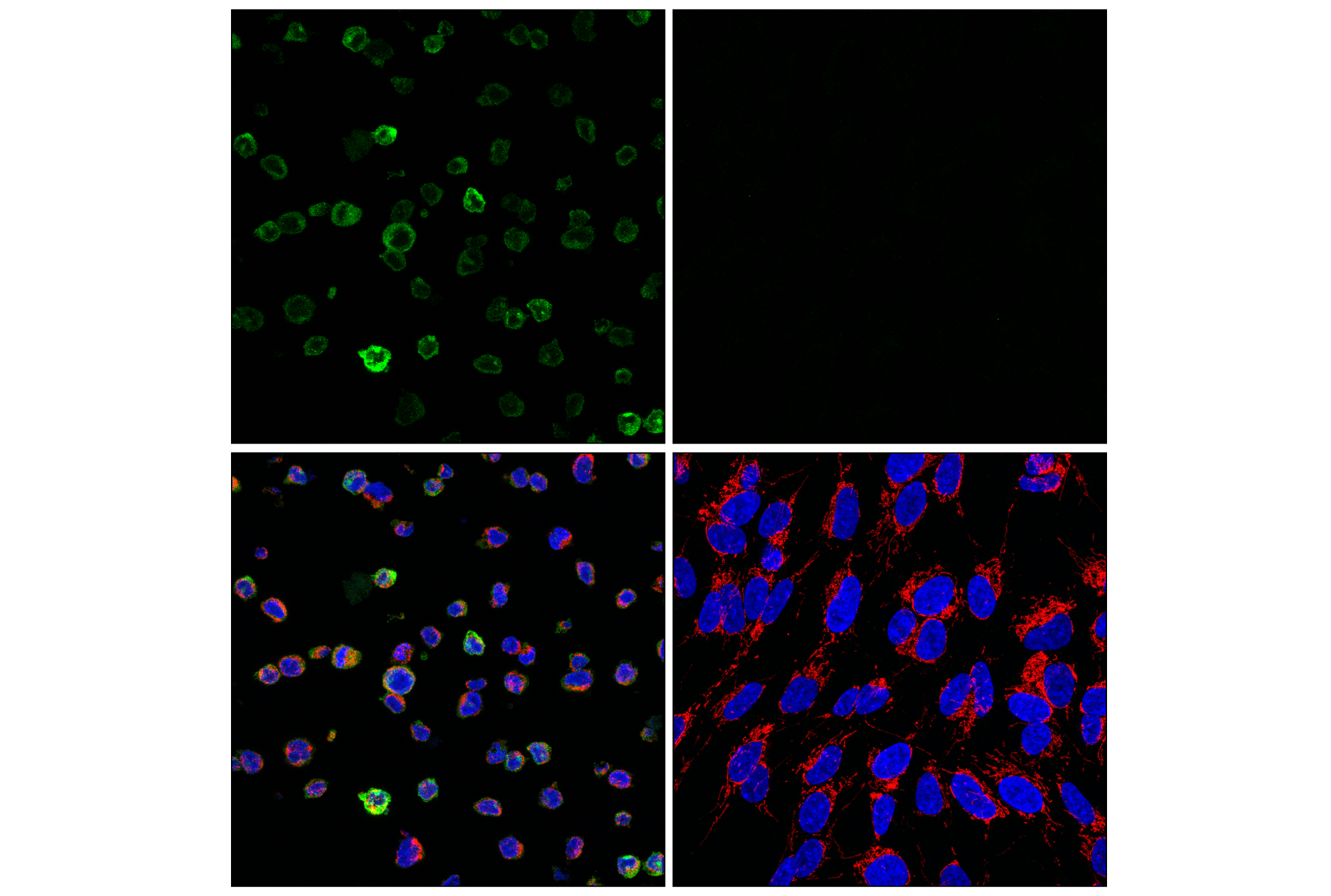 TREM2 (E4F5G) Mouse mAb | Cell Signaling Technology