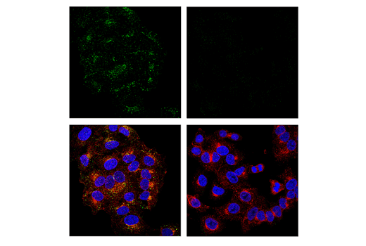 Immunofluorescence Image 3: APP (E5X2B) Rabbit mAb
