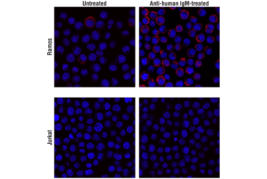 Immunofluorescence Image 1: Phospho-CD79A (Tyr182) (D1B9) Rabbit mAb (Alexa Fluor® 647 Conjugate)