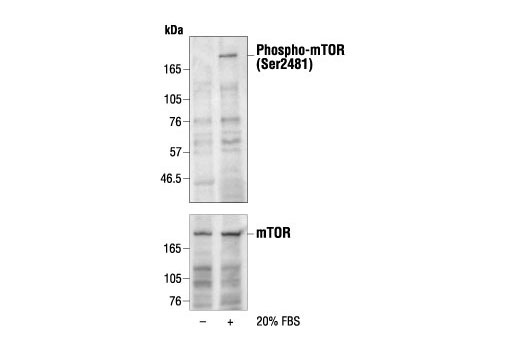 Western Blotting Image 1: Phospho-mTOR (Ser2481) Antibody