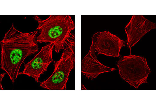 Immunofluorescence Image 1: Phospho-SRC-3 (Thr24) Antibody