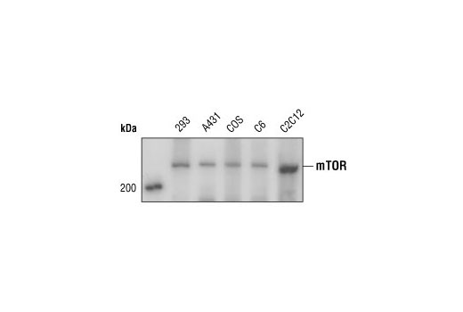  Image 1: Cannabinoid Receptor 1 Downstream Signaling Antibody Sampler Kit
