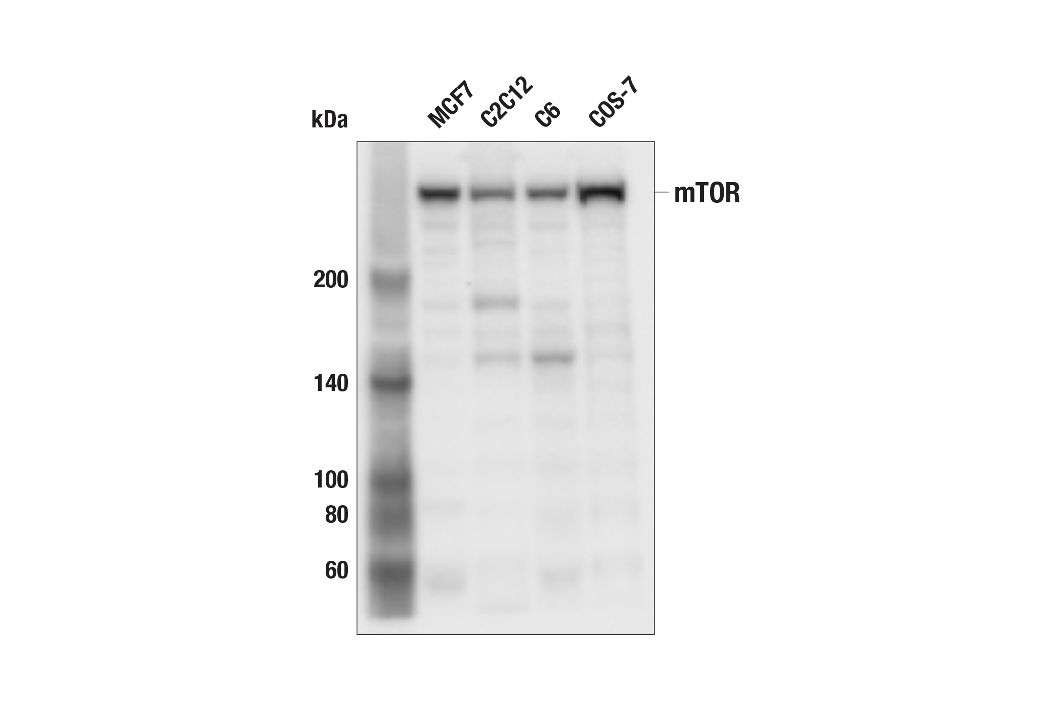  Image 1: Cannabinoid Receptor 1 Downstream Signaling Antibody Sampler Kit
