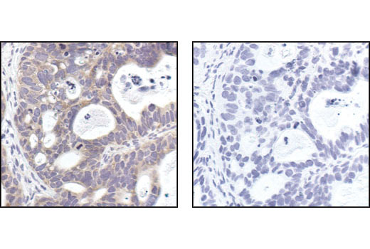 Image 34: Cannabinoid Receptor 1 Downstream Signaling Antibody Sampler Kit