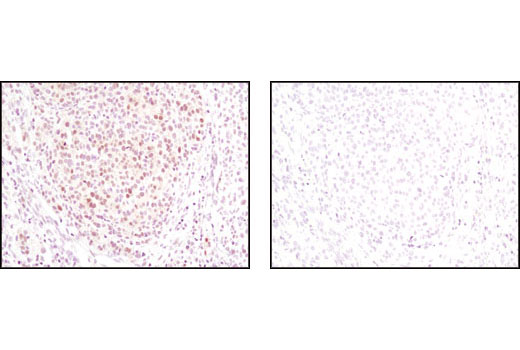 Immunohistochemistry Image 1: ASF1A (C6E10) Rabbit mAb
