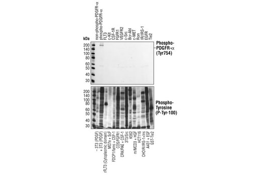 Western Blotting Image 1: Phospho-PDGF Receptor α (Tyr754) (23B2) Rabbit mAb